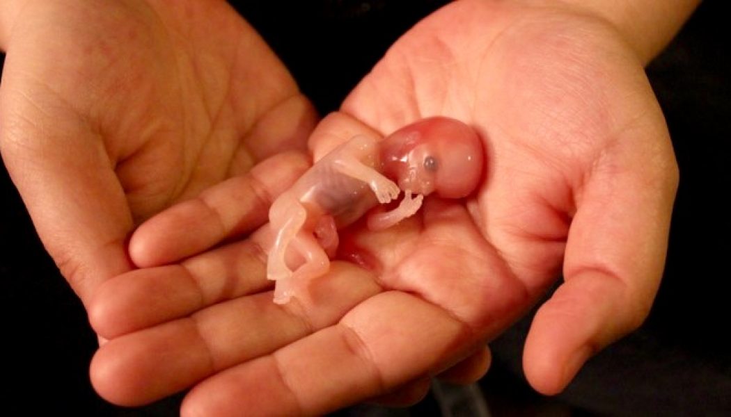 Allongement du délai pour avorter. Pr Nisand : « La tête du fœtus est ossifiée et il faut l’écraser»