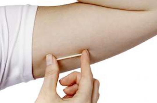 Elle perd l’usage de sa main après le retrait de son implant contraceptif