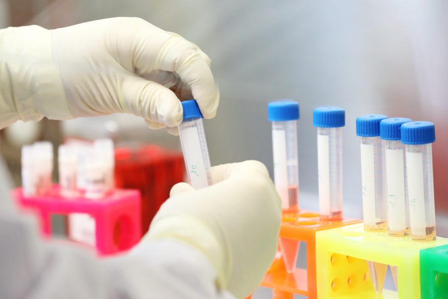 Un partenariat stratégique pour la recherche sur la trisomie 21 et la maladie d’Alzheimer