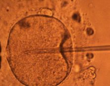 Inscrivez-vous à la neuvaine pour préparer la prochaine lecture de la loi de bioéthique