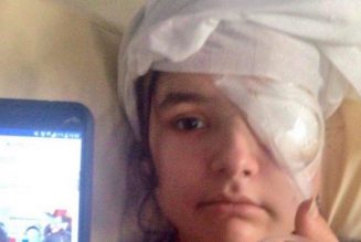 Fiorina, 20 ans, éborgnée par les forces du régime Macron !