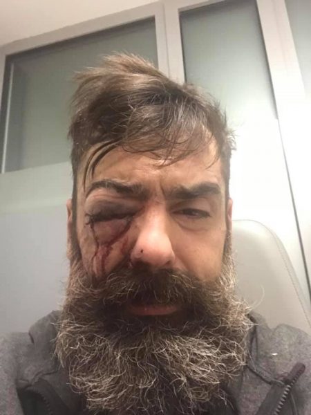 Répression policière : il est temps d’ouvrir une enquête en flagrance criminelle