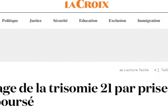 Trisomie : cette pseudo-objectivité est glaçante