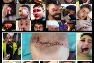 Violences policières : cela commence à sortir