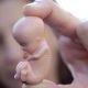 Plus de 12 000 enfants sauvés de l’avortement en Russie