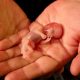Pratiquer des avortements n’attire pas les médecins italiens