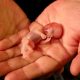 383 460 avortements pratiqués par le Planned Parenthood en 2021